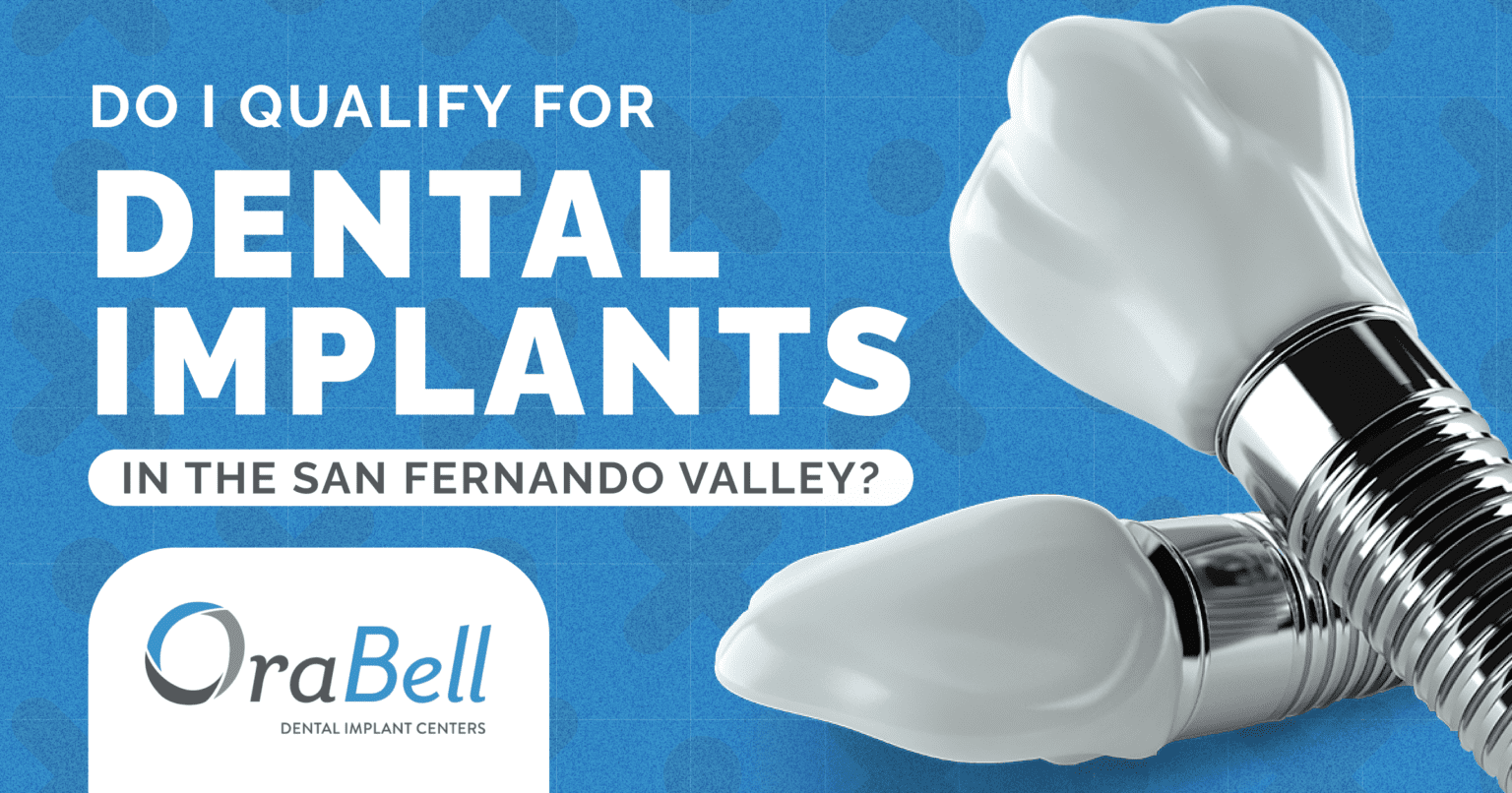 Do I Qualify For Dental Implants In The San Fernando Valley? | OraBell